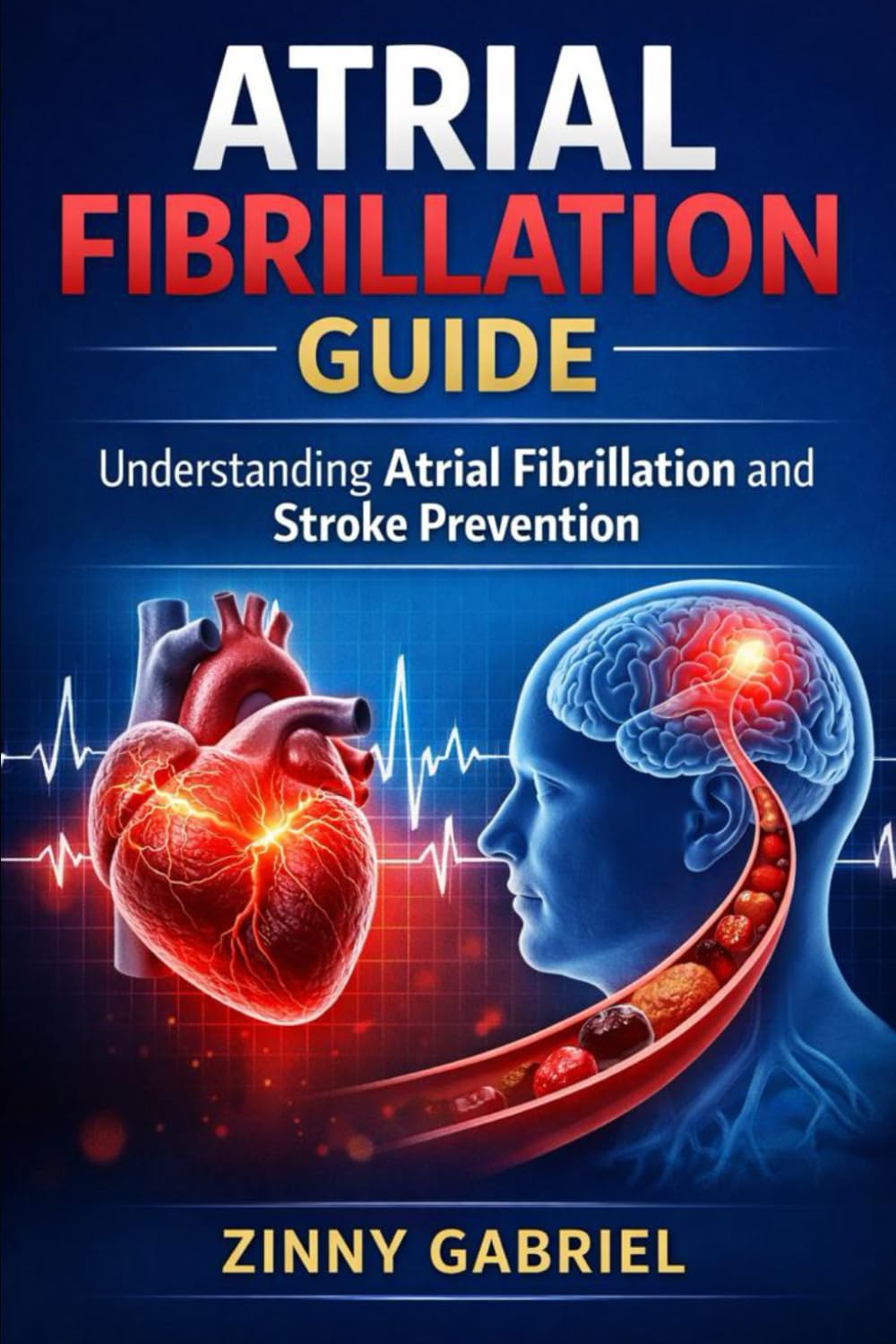 ATRIAL FIBRILLATION GUIDE: Understanding Atrial Fibrillation and Stroke Prevention