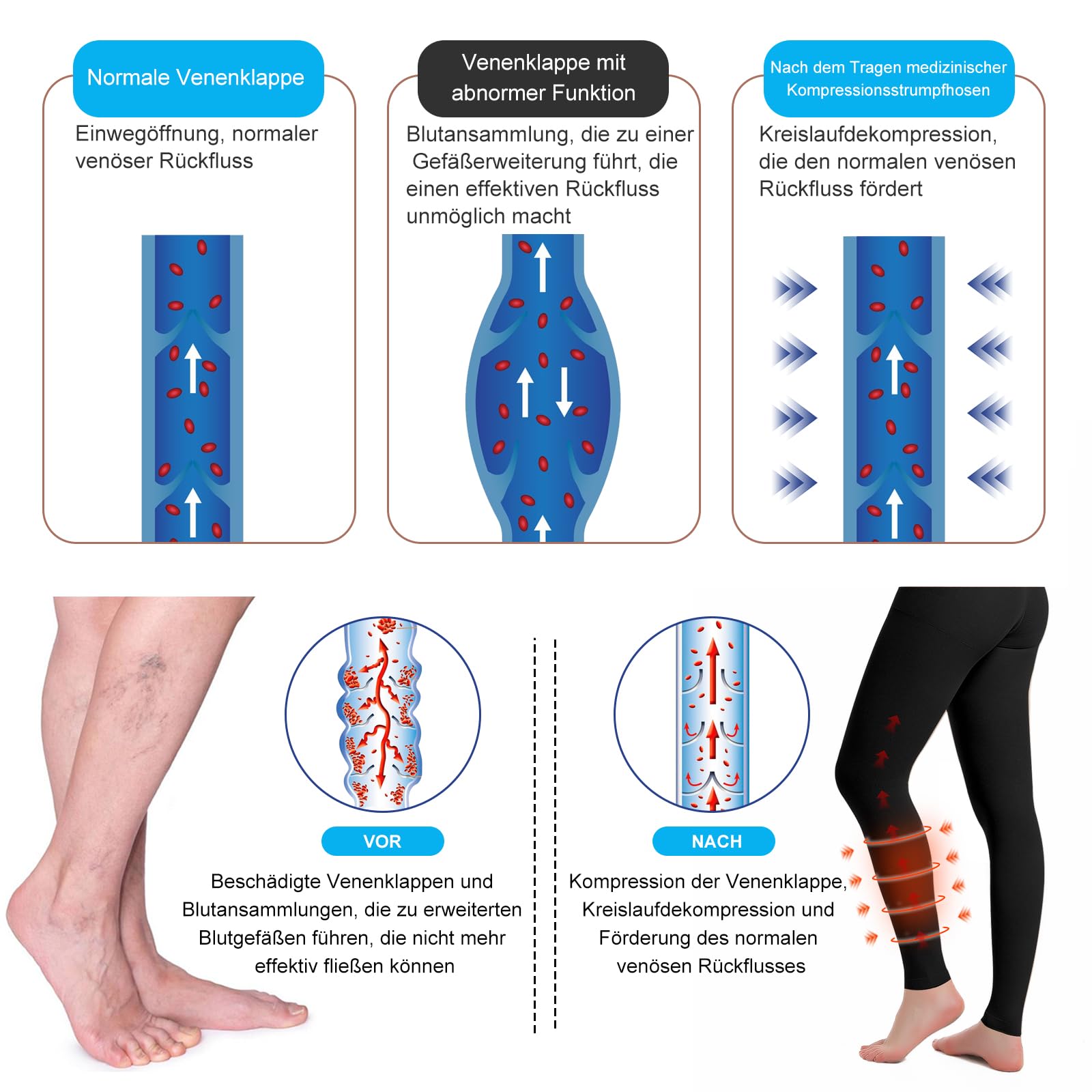 Bas de compression médicaux 20-30 mmHg classe 2, collants de soutien progressif, pantalon de compression opaque à bout ouvert
