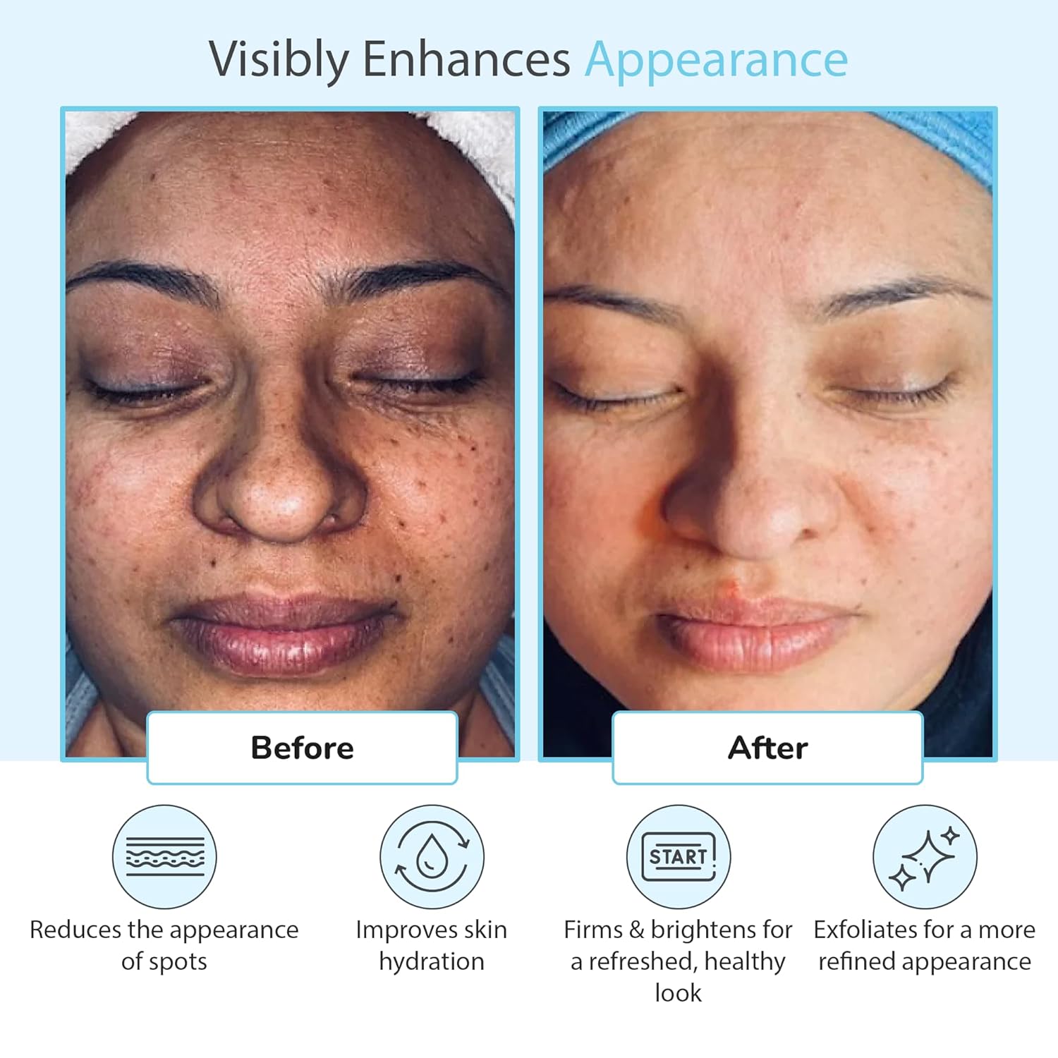 Glycolic Acid 50% Gel Peel - Enhanced with Retinol & Green Tea Extract (Professional Skin Peel)1 ounce - Image 5