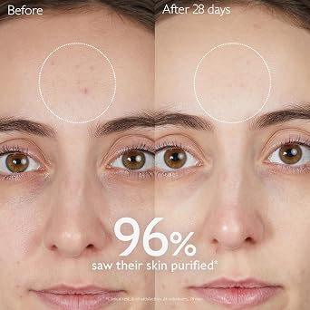 Caudalie Vinopure Temizleyici Temizleme Jeli, Salisilik Asitli - 150 ml