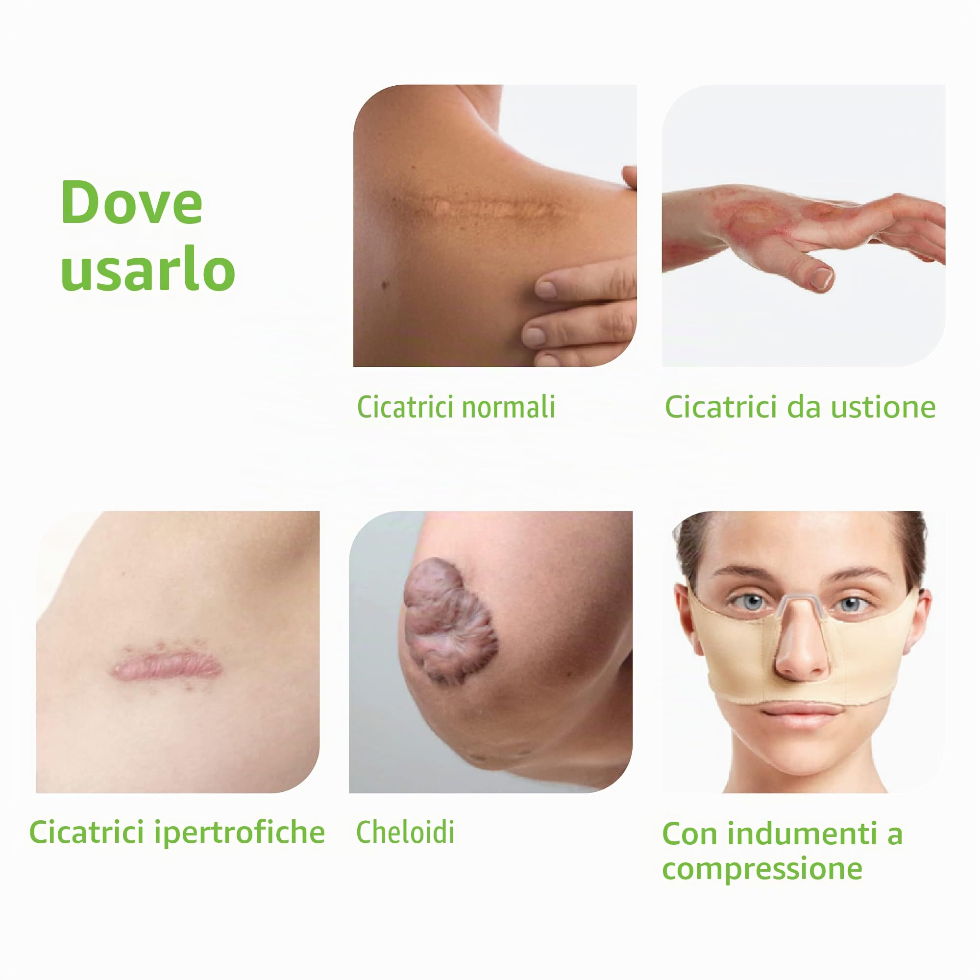 Skin feel - Riduce Tutti i Tipi di Cicatrici e Ustioni - Silicone Medico - 5 Piastre Sottili - Sana e Previene Cheloidi e Cicatrici Ipertrofiche (4 x 30cm)