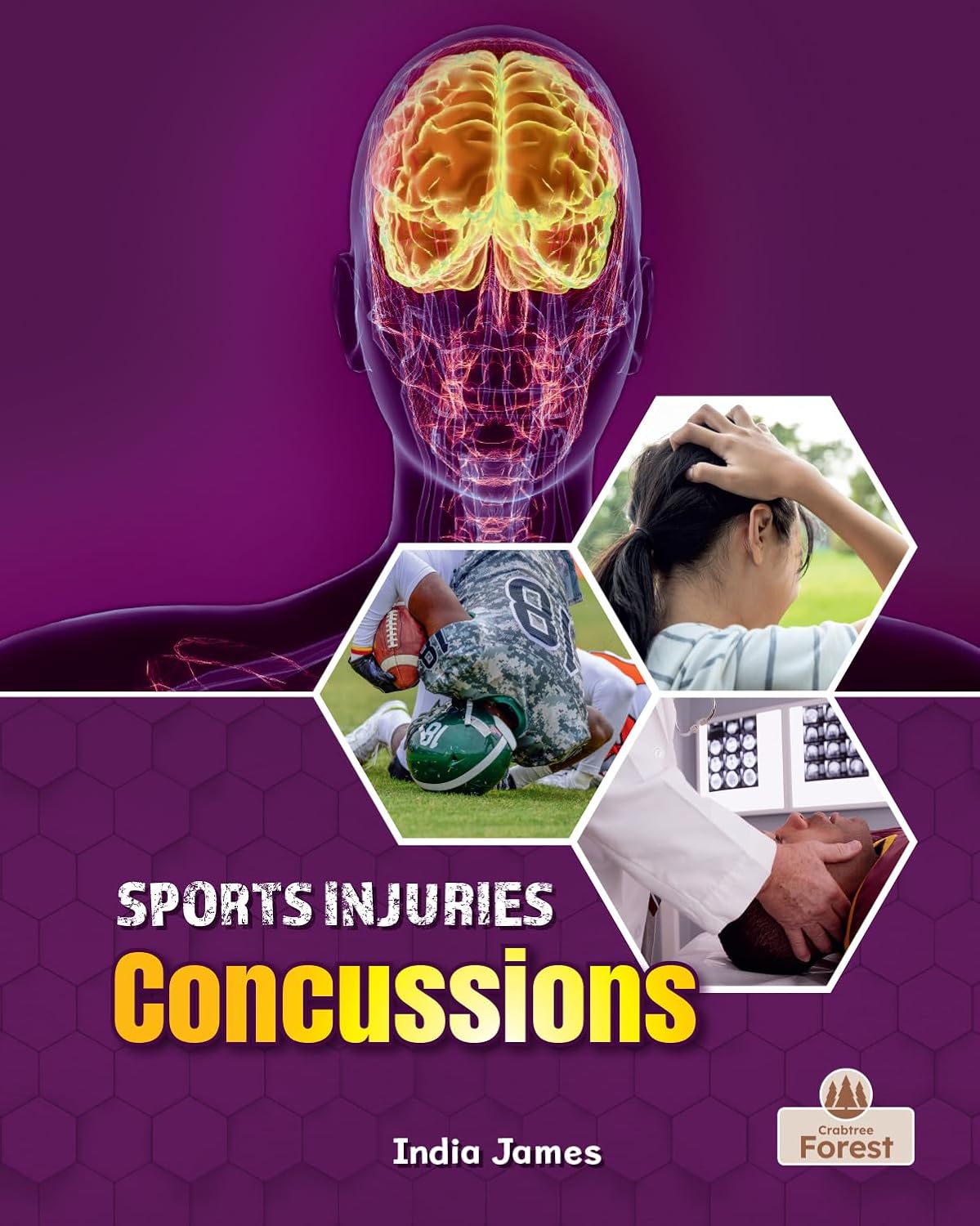 Concussions (Sports Injuries)