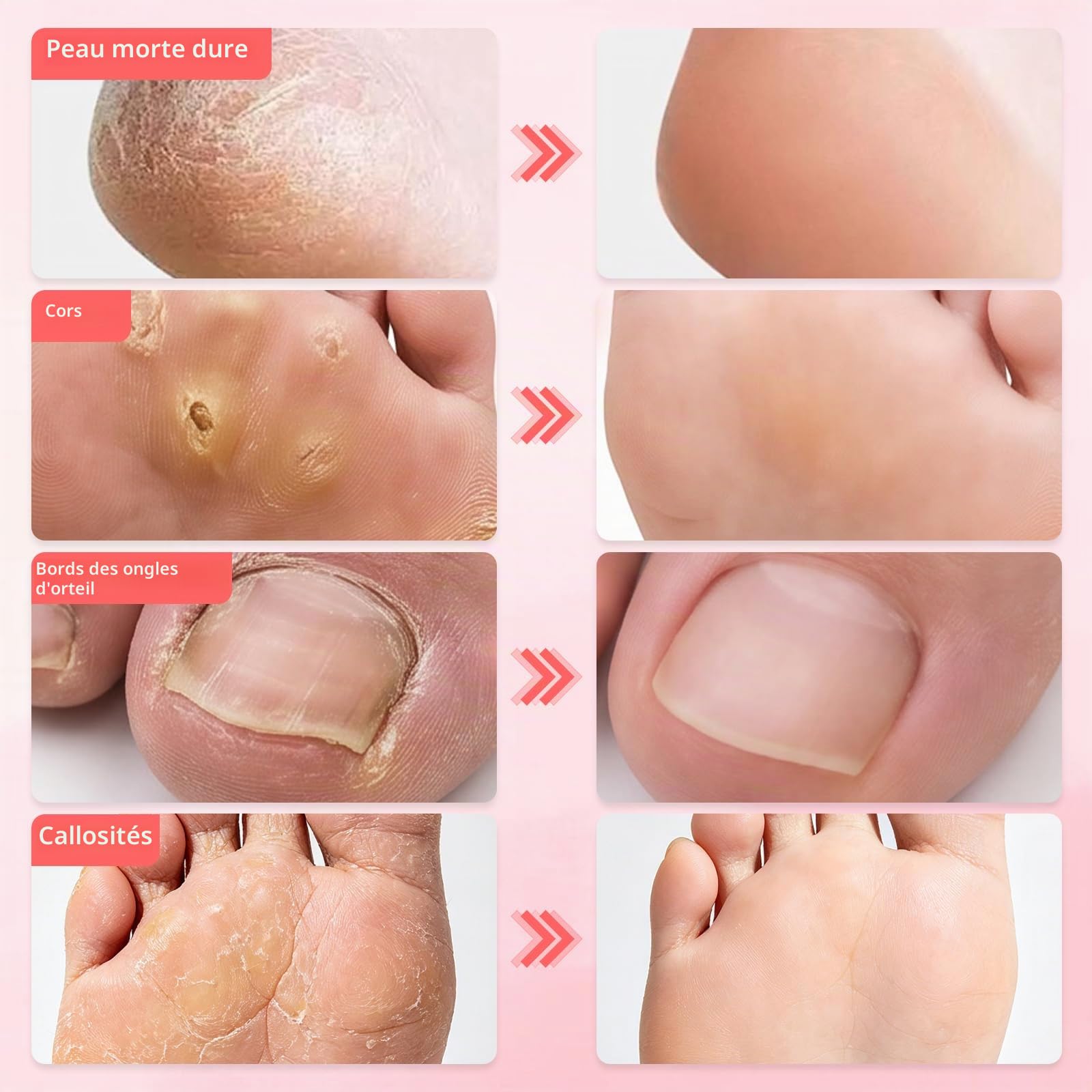 Râpe à pied électrique professionnelle – Ponceuse pour callosités et talons secs, appareil pédicure anti-peau morte, vitesse réglable, 120 disques abrasifs + brosse (Rose)