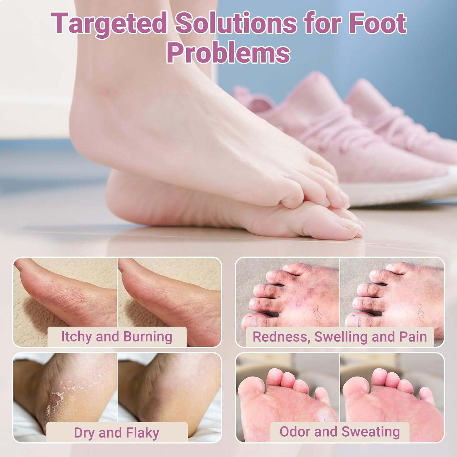 Athletes Foot Antifungal Cream, Extra Strength Anti Fungal Treatment Ointment with Natural Herbal Ingredients for Tinea Pedis, Jock Itch, Ringworm, Tinea Versicolor, 3.53oz - Image 4