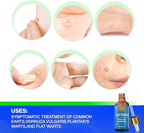 Miniatura 2 de Liquid Wart Remover - Loción avanzada para tratamiento de verrugas para todo tipo de verrugas, incluyendo comunes y genitales, sin dolor y de acción