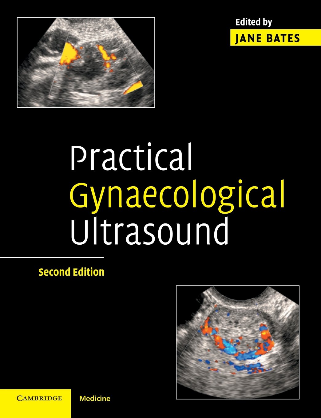 Practical Gynaecological Ultrasound by Jane Bates - 9780521674508