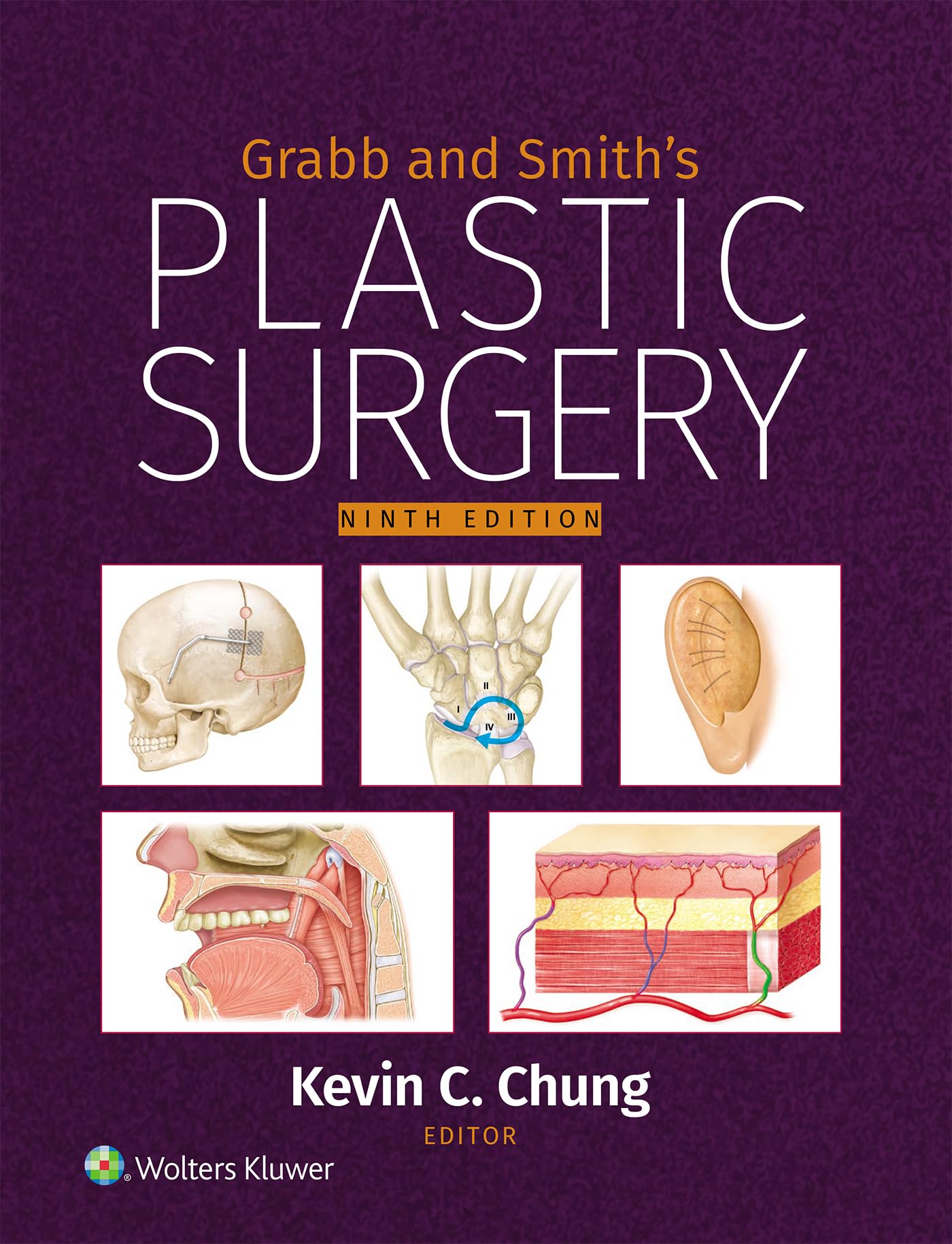 Grabb and Smith's Plastic Surgery: eBook without Multimedia (English Edition)