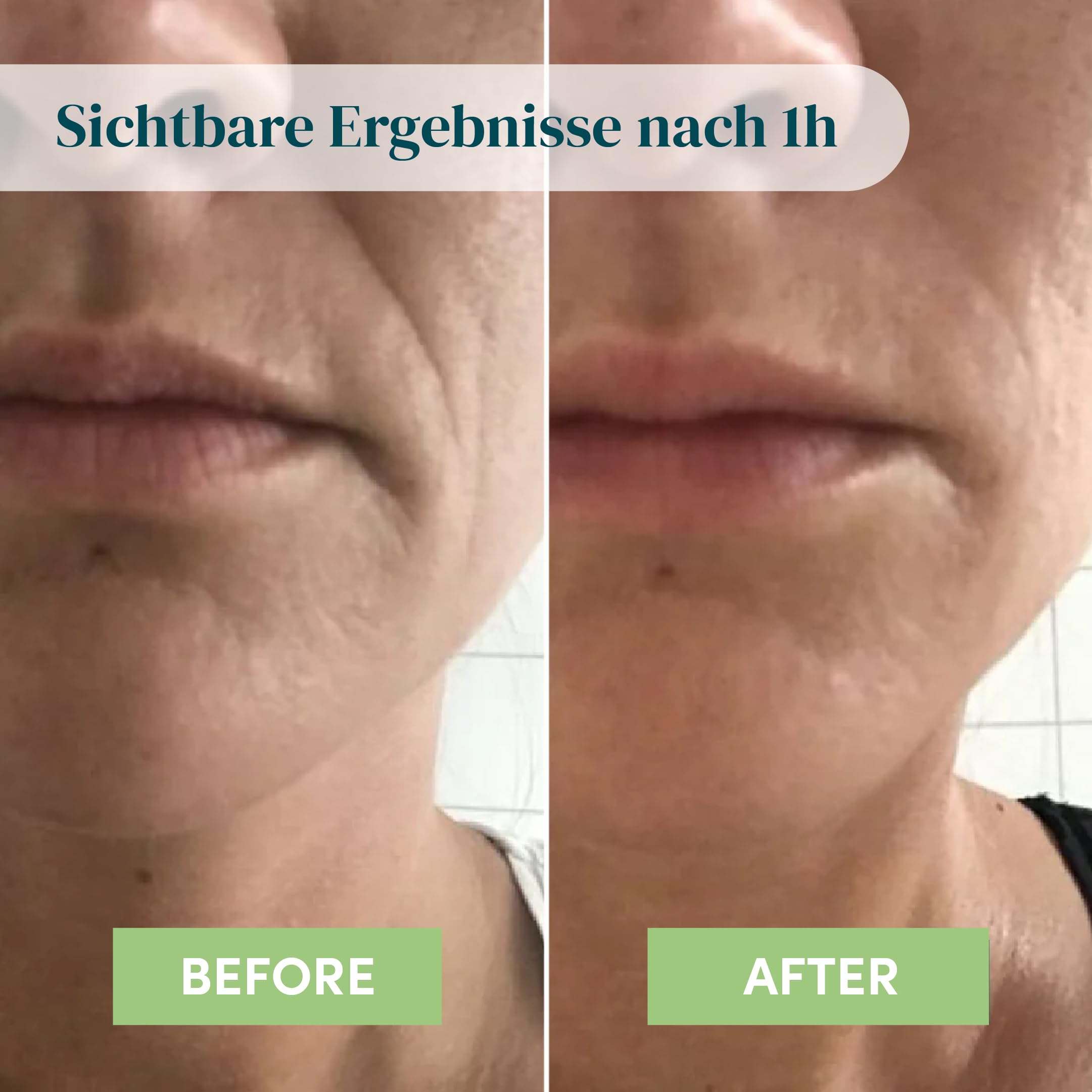 APRICOT - Cuscinetti pieghevoli in silicone medico con acido ialuronico a basso peso molecolare – Riutilizzabili fino a 30 volte, dermatologicamente confermato, vegano e senza sperimentazione su