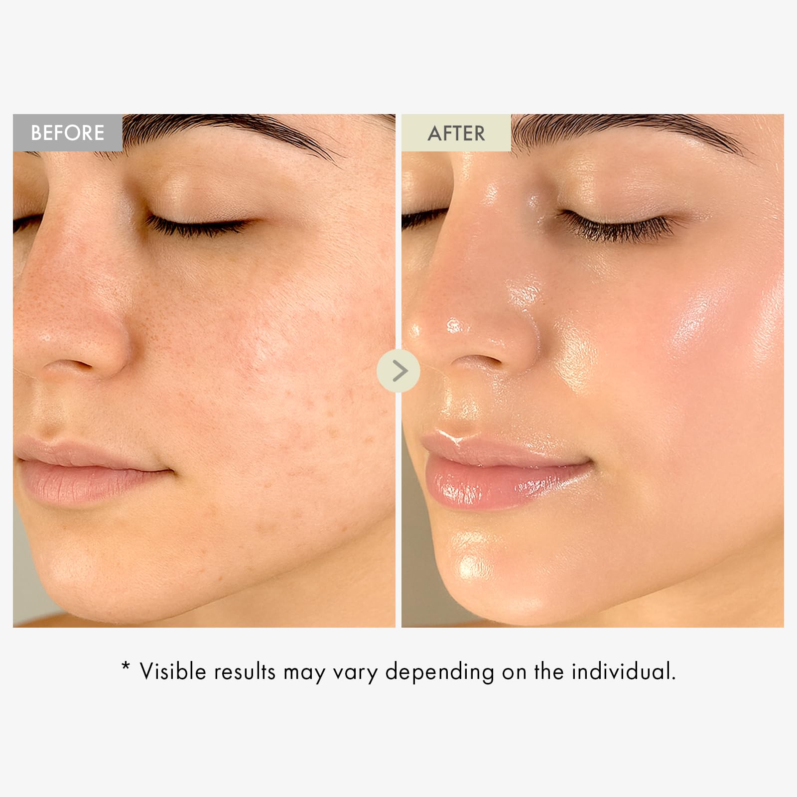 TOSOWOONG Duo Éclat Collagène : Real Collagen Fit & Sérum Visage pour un Éclat Jeune