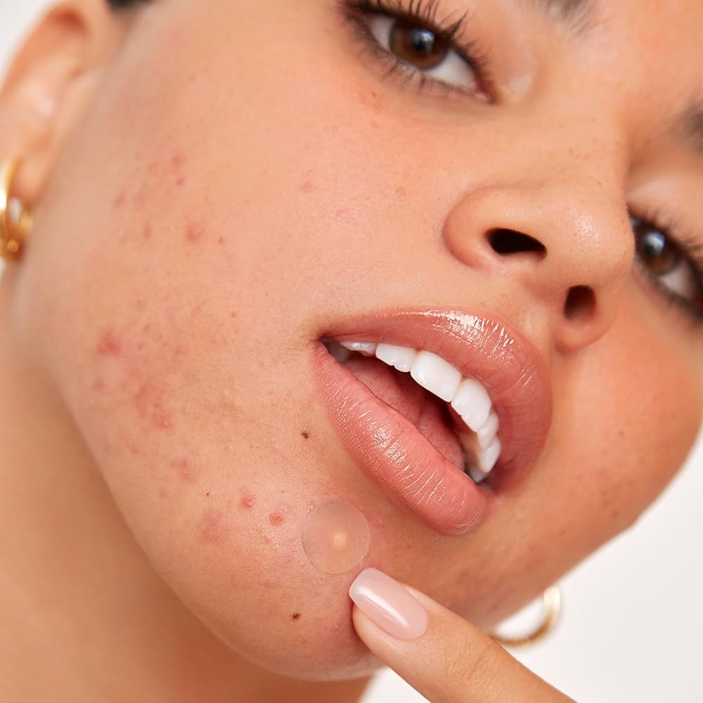 PEACE OUT☆ニキビケア美容液☆Salicylic Acid Acne Treatment Salicylic Acid Acne Treatment Serum | Oprah Daily Shop