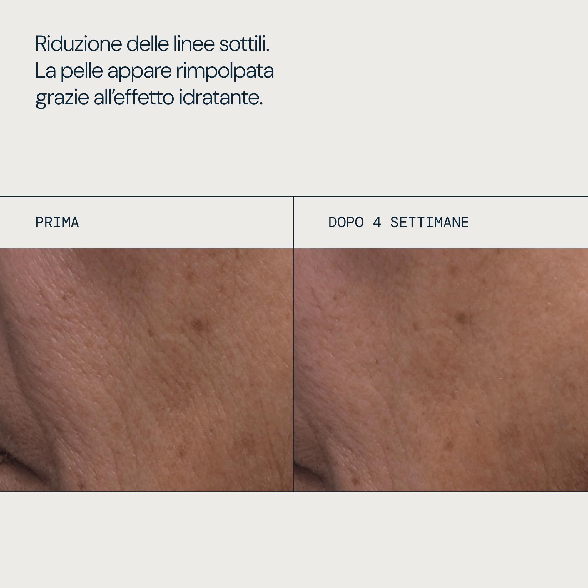 ELEMIS Pro-Collagen Rose Micro Serum 30ml, Clinicamente Testato - Siero Viso Idratante con Estratto di Rosa, Siero Anti Età per una Pelle Rimpolpata, Luminosa e Intensamente Idratata