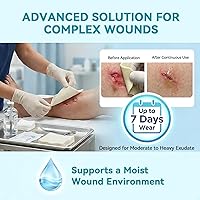 Vista 4 de Dimora Apósito para heridas de alginato de calcio, parches de 4 x 4 pulgadas, 10 almohadillas estériles individuales, gasa suave y altamente