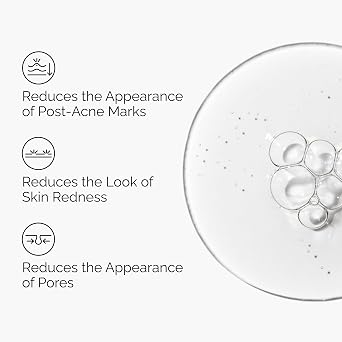 The Ordinary Aloe 2% + NAG 2% Solution, Soothes Skin and Targets Post-Acne Marks, 1 Fl Oz