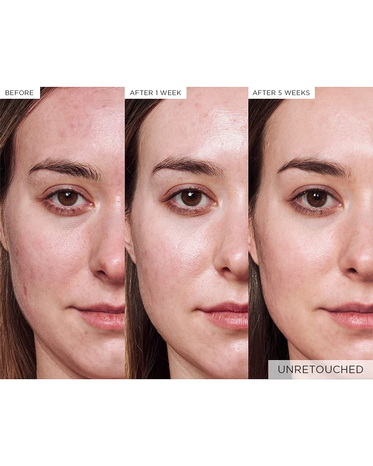 Glow Recipe Avocado Ceramide Serum - Soothing, Hydrating Face Serum for Women & Men, Redness Relief & Skin Barrier Repair - Lightweight, Milky Korean Skincare for Dry, Sensitive Skin (30 ml) - Image 8