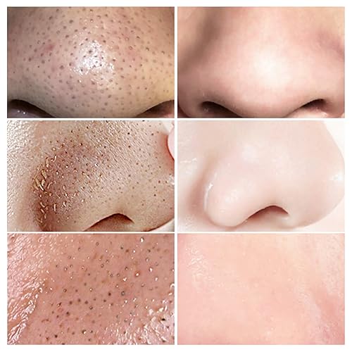 Miniatura 2 de LANBENA Máscara eliminadora de puntos negros, máscara eliminadora de puntos negros, máscara 2 en 1, aceite de té verde, eliminación de puntos