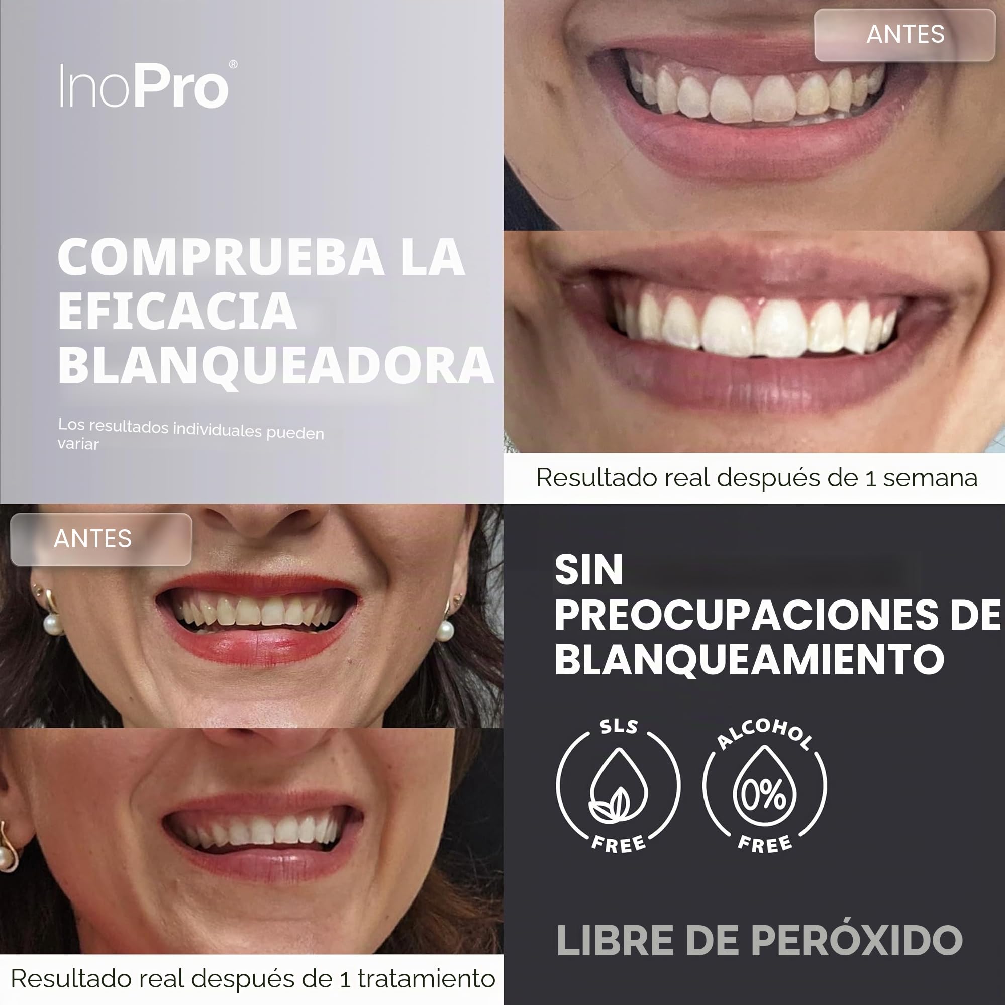 InoPro - Juego de tiras blanqueadoras para dientes naturales, 14 tratamientos: blanqueamiento para dientes sensibles, sin peróxido, bandas blancas que no dañan el esmalte, eliminación de manchas