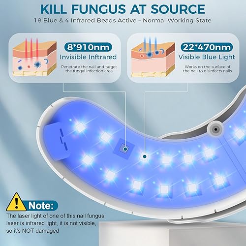 Miniatura 6 de Dispositivo de luz LED para tratamiento láser de hongos en las uñas, dispositivo de luz de hongos en las uñas, removedor de hongos en las uñas