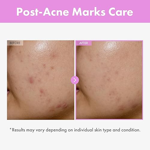 Miniatura 3 de TOSOWOONG Suero potenciador de la piel de 9 péptidos, niacinamida y ácido hialurónico que mejora la renovación de la piel, esencia facial para todo