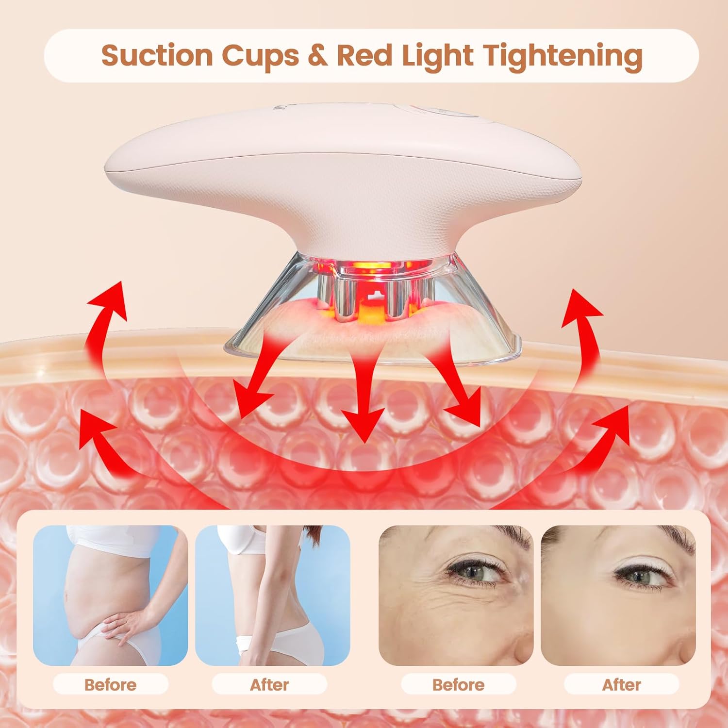 Cellulite Massage Tool &Amp; Body Sculpting Machine – Anti Cellu...