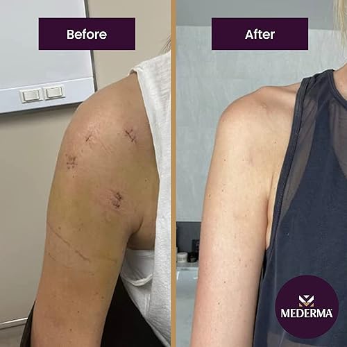 Miniatura 3 de Mederma Gel de cicatriz avanzado de secado rápido con aceite para cicatrices y estrías