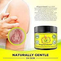 Vista 4 de Ringworm Relief Fast Cream Ointment Dermatologist & Lab Tested Better Than Shampoo Adults and Kids Natural Extra Strength No Paraben No Chemicals