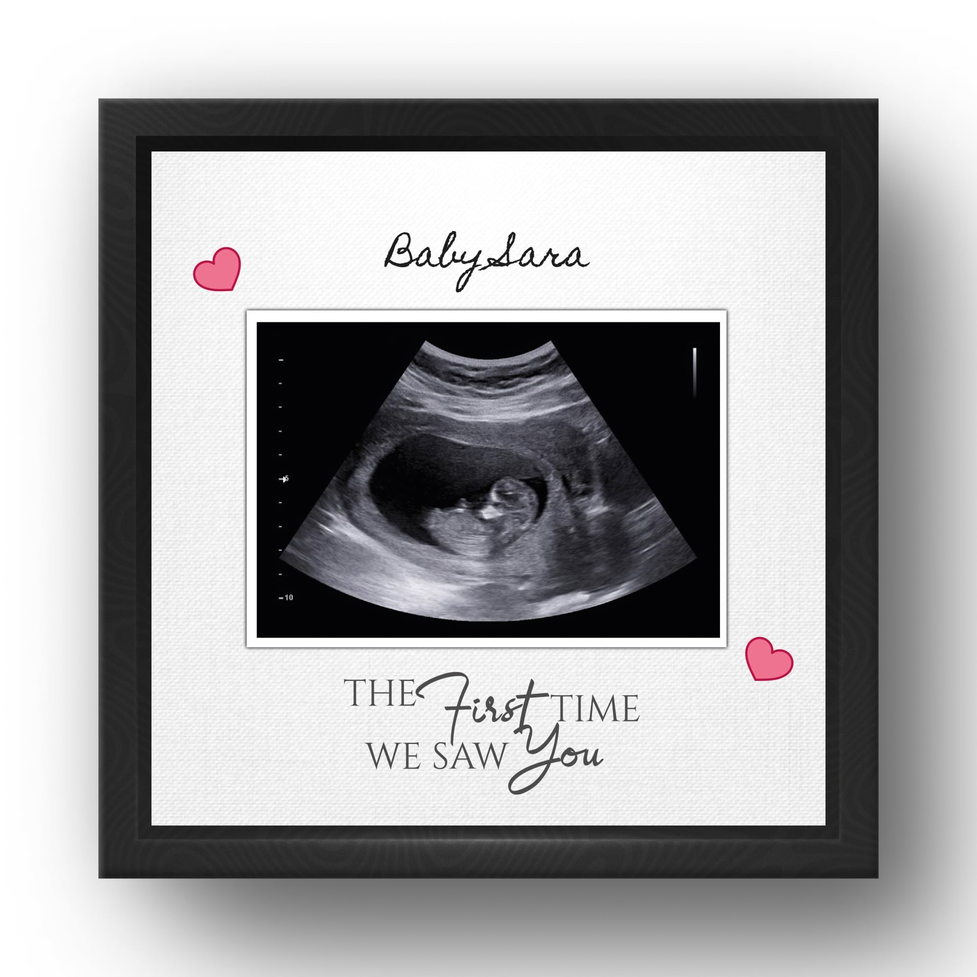 Smile Shop India - Personalized Baby Sonogram Photo Frame – Custom Ultrasound Picture Frame Wall or Table Decor – (Customizable) (Design 1)-image-14