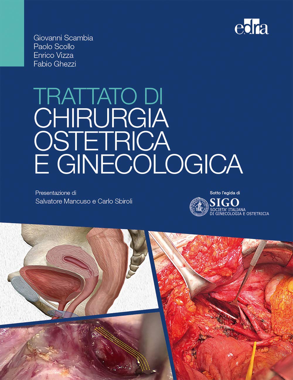 Trattato Di Chirurgia Ostetrica E Ginecologica - 4