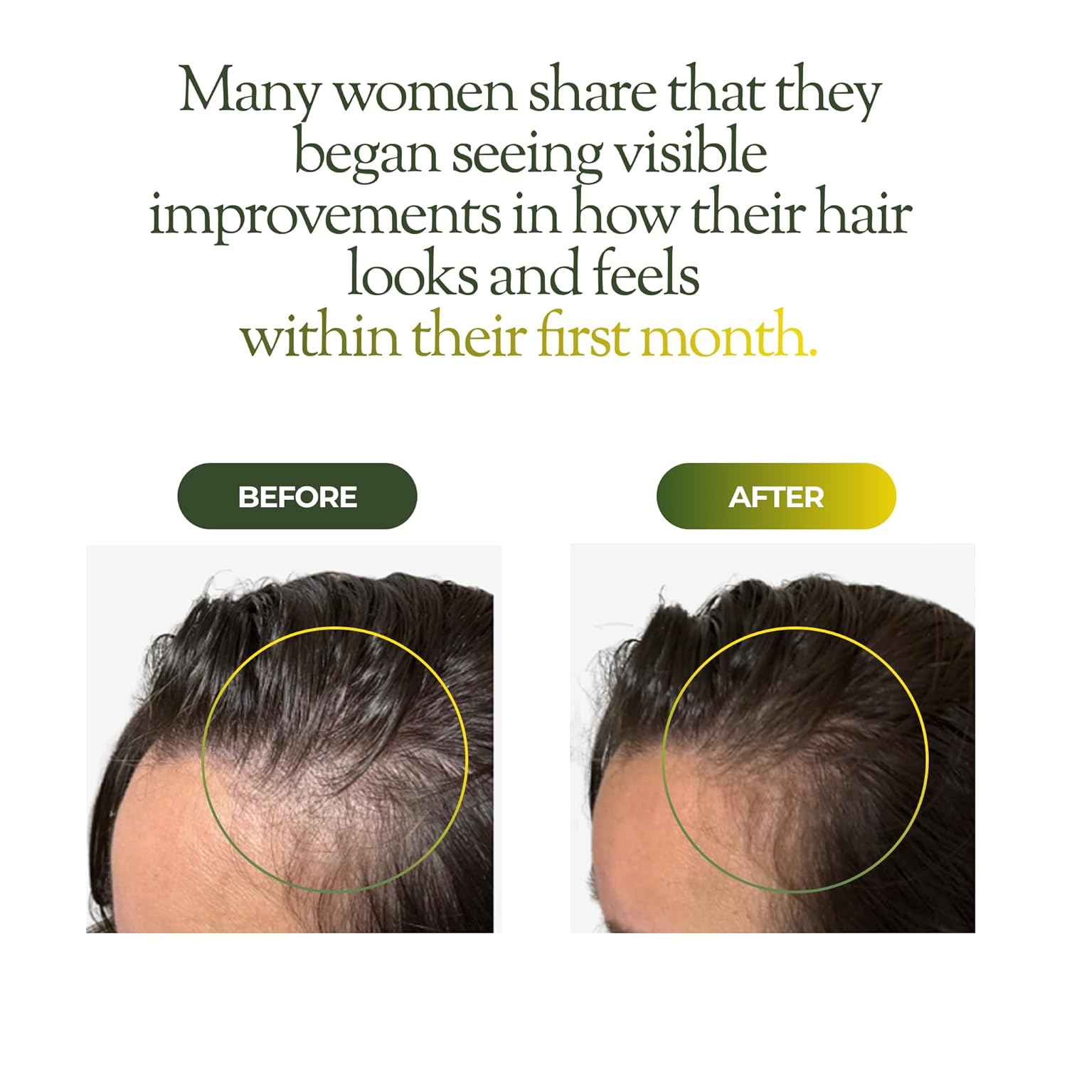 regener8 Hair & Scalp Oil for Women – Essential & Carrier Oil Blend for Hormone-Related Thinning & Loss – Natural Support for Postpartum, Menopause & Chronic Stress - Image 3