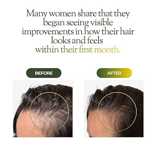 Miniatura 3 de regener8 Aceite para el cabello y el cuero cabelludo para mujeres, mezcla de aceites esenciales y portadores para adelgazamiento y pérdida