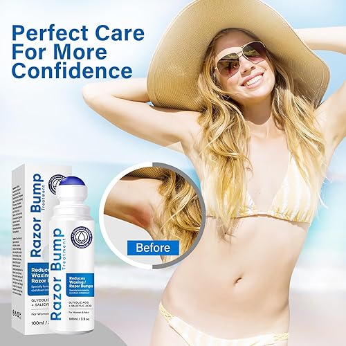 Miniatura 7 de Tratamiento de golpes de afeitado para hombres y mujeres, suero para cuidado después del afeitado para encarnados y quemaduras, solución de tapón