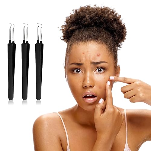 Miniatura 4 de 3 pinzas para puntos negros, de acero inoxidable, extractor de espinillas, herramienta para eliminar puntos negros, espinillas, espinillas, curva