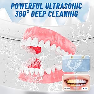 Ruolar Ultrasonic Retainer Cleaner Machine for Dentures | 45kHz Dental Cleaning Pod for Mouth Guards, Aligner, Nightguard, Braces, Jewelry | 3 Timer Modes Denture Cleaner- Cooling Fan & Split-Design