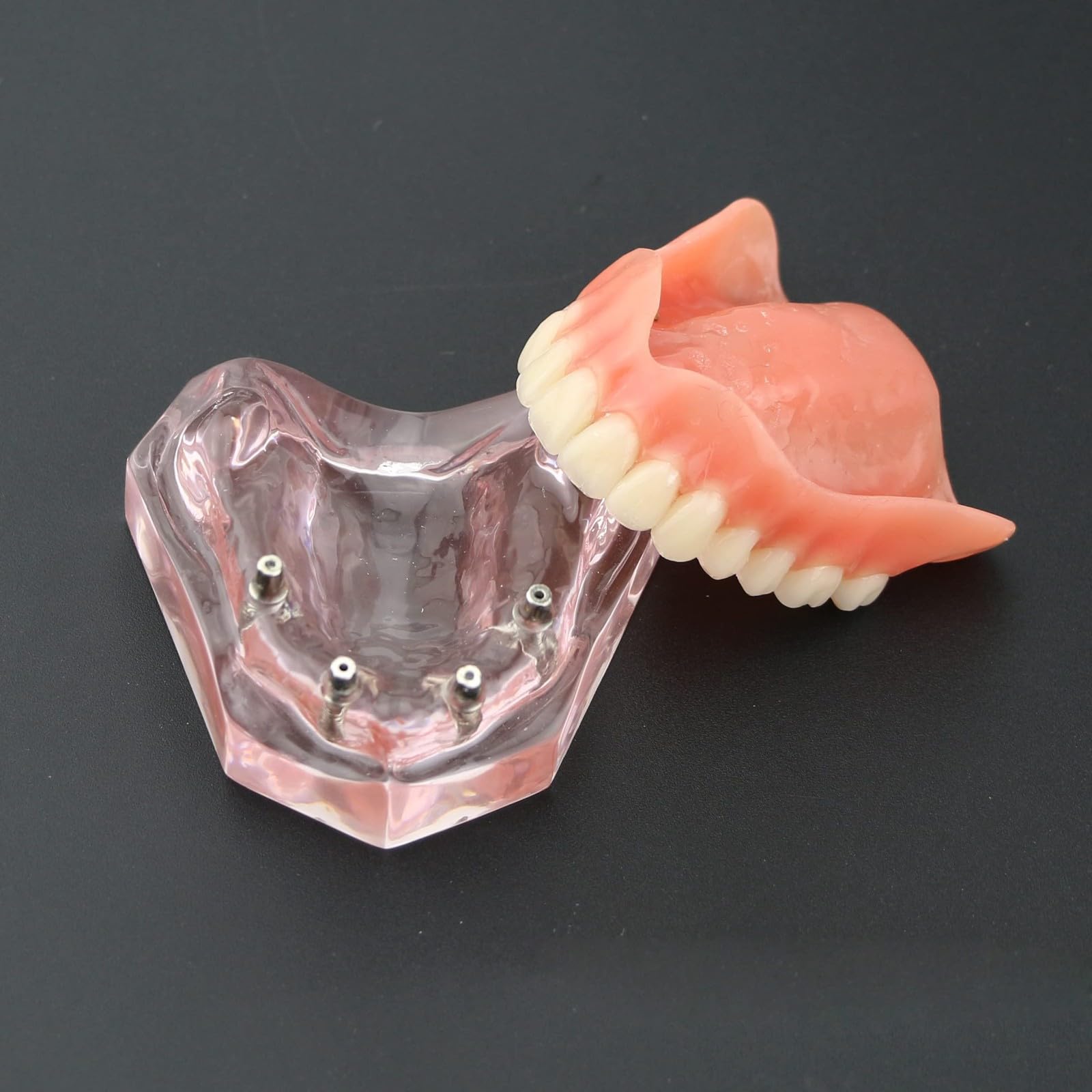 Modelo de dientes para implantes dentales tipodonto, rosa transparente, restauración de implantes dentales tipodonto, sobredentadura, 4 implantes, superior, demostración para estudio y enseñanza.