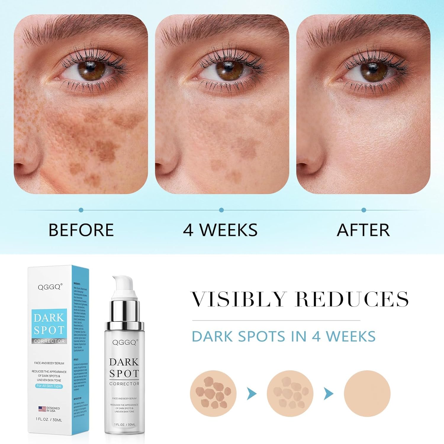 Dark Spot, Dark Spot Remover for Face and Body with Niacinamide & Alpha-Arbutin | Serum for Age Spots, Sun Spots, Melasma | All Skin Types, Men & Women
