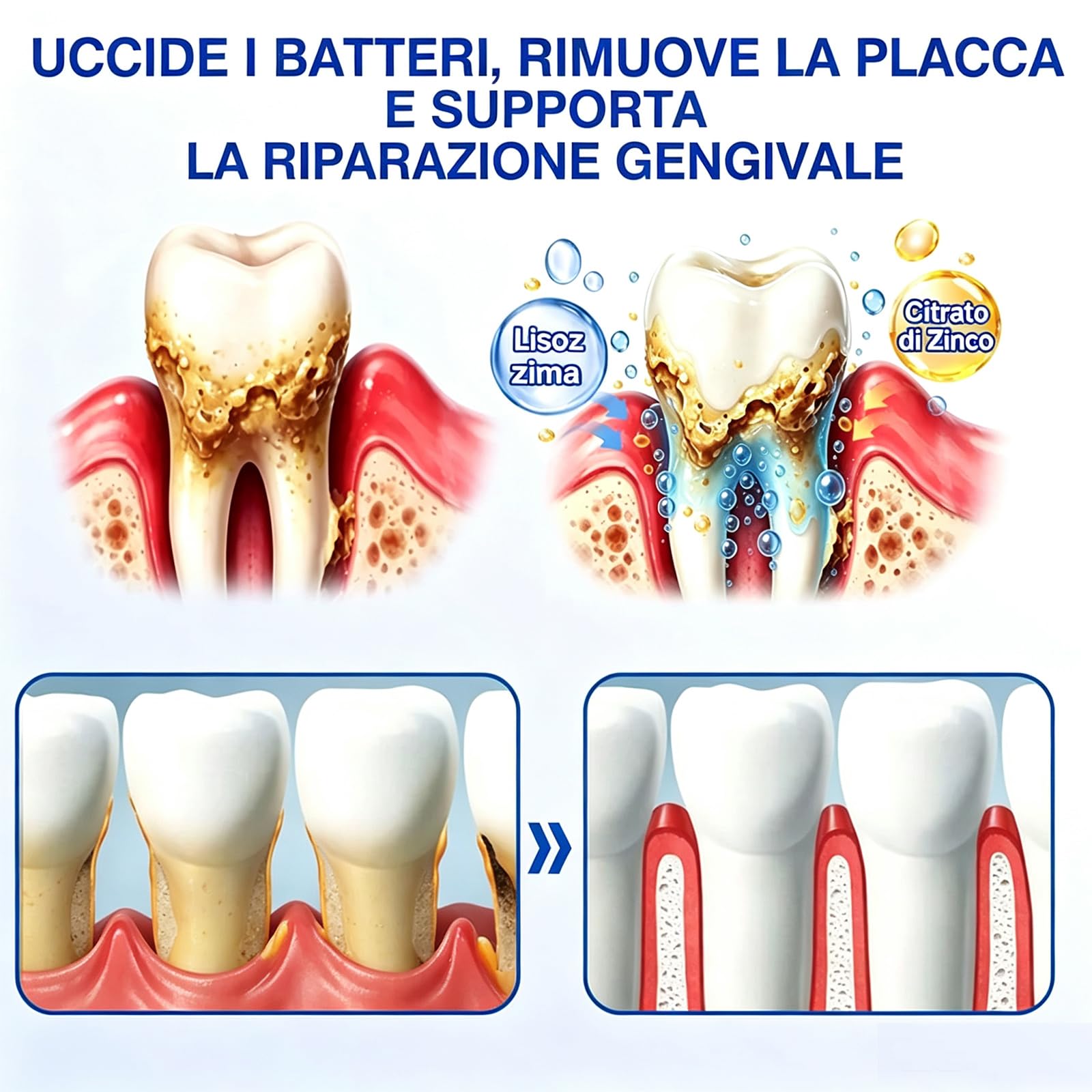 Glimmerly Gumrevive Gel Parodontale Rigenerante - 3 X 3 Ml/4Confezione | Sbiancamento Dentale Profondo, Gel Lenitivo Naturale Per La Protezione Delle Gengive, Sollievo Rapido, Alito Fresco