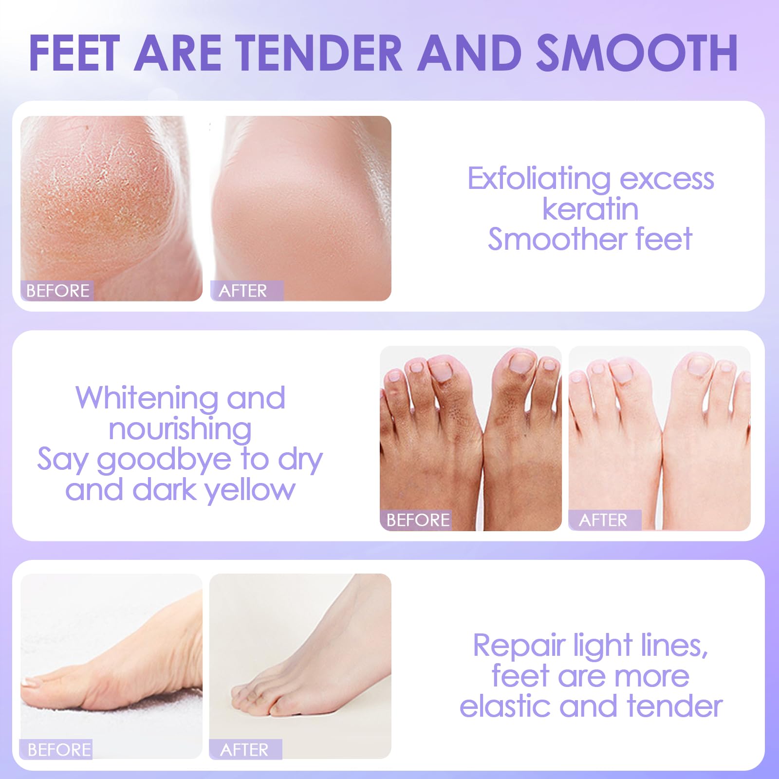 2 Paia Maschera Piedi Esfoliante, Rimuove Pelle Morta Ripara Talloni, Maschera idratante i piedi una pelle liscia per uomini e donne, (Pesca & lavanda)