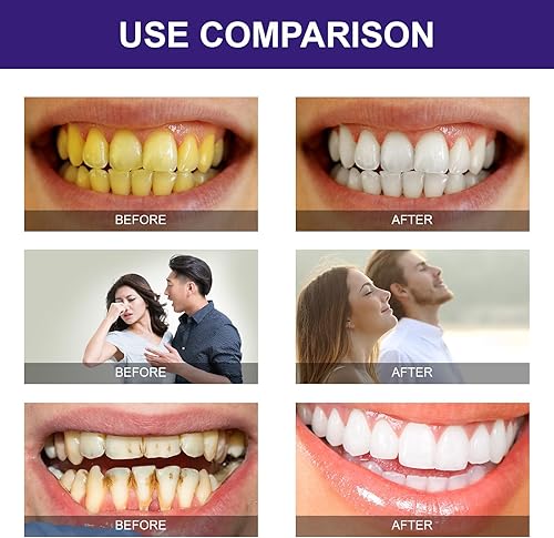 Miniatura 7 de 1 Bottle-SIL VFR Pasta de dientes púrpura para blanqueamiento dental, pasta de dientes morada, corrector de color de dientes, eliminación de manchas