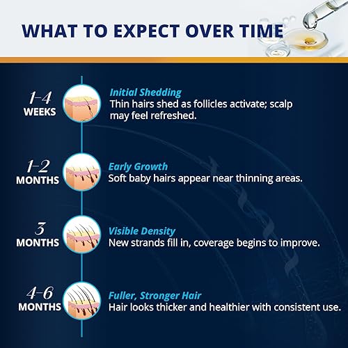 Miniatura 5 de Kit de crecimiento de cabello y barba de minoxidil al 5% suero tópico de minoxidil extra fuerte para el crecimiento del cabello para adelgazar