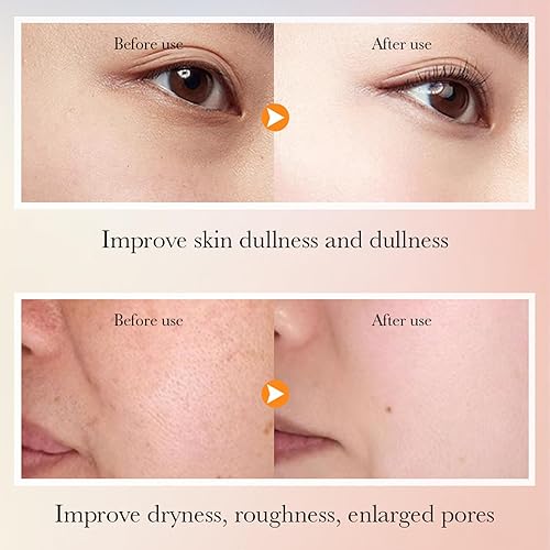 Miniatura 3 de Juego de regalo hidratante de 6 piezas para el cuidado de la piel para mujeres, kit de cuidado facial con vitamina C, incluye limpiador, tóner,