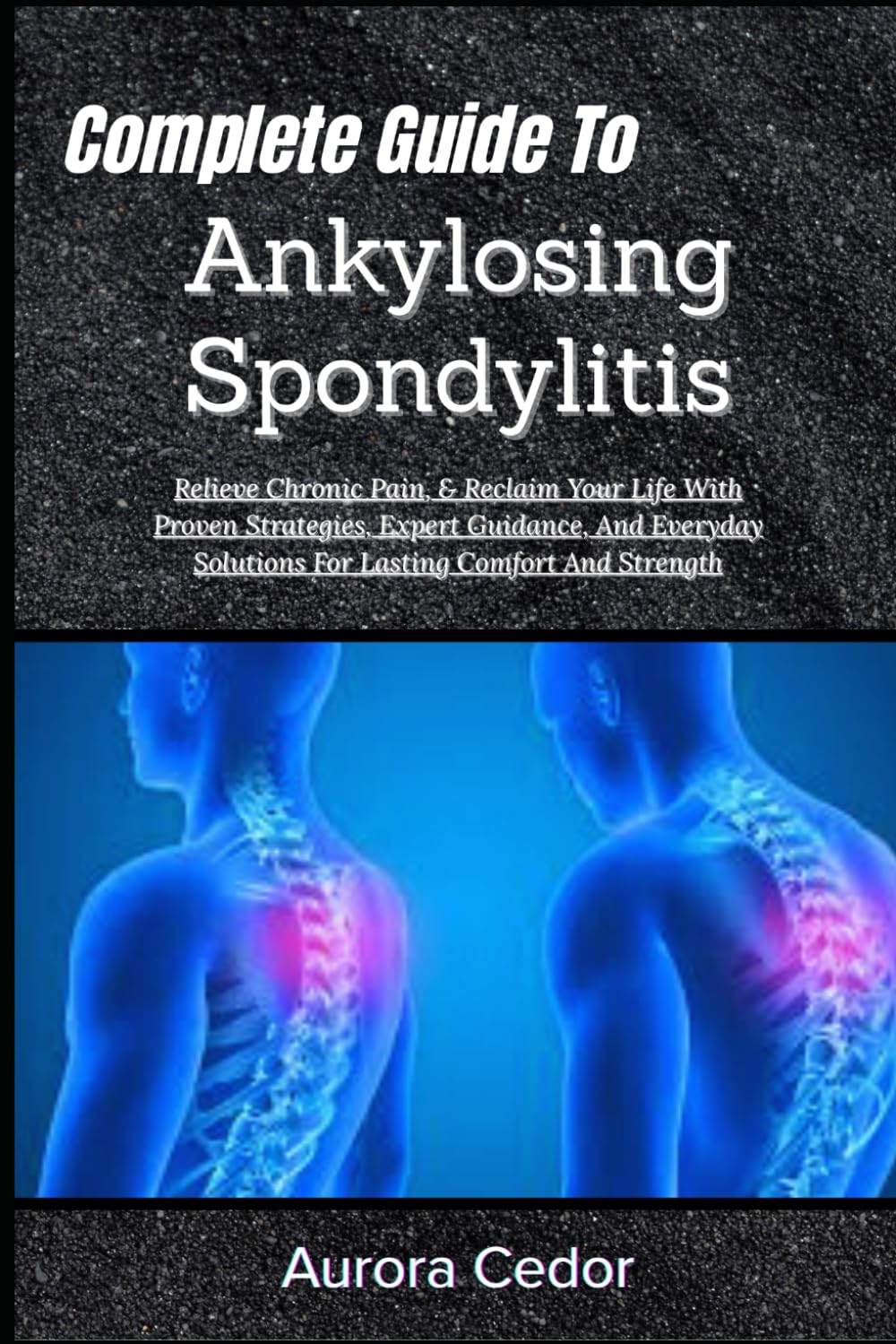 Complete Guide To Ankylosing Spondylitis: Relieve Chronic Pain, & Reclaim Your Life With Proven Strategies, Expert Guidance, And Everyday Solutions For Lasting Comfort And Strength
