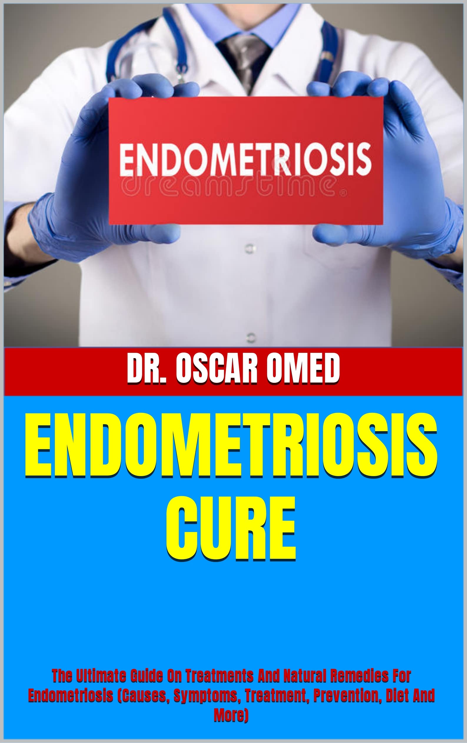 Buy ENDOMETRIOSIS CURE The Ultimate Guide On s And Natural Remedies