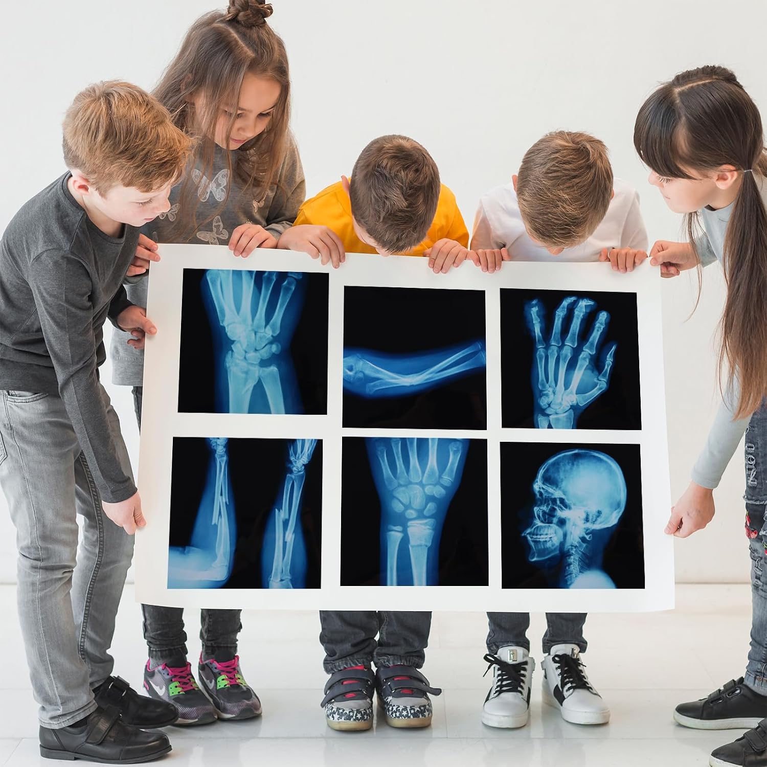 16Pcs Realistic Broken Bones X-Ray (9.8"x9.8") Skeleton X-Rays Human Skeleton Broken Bones PVC Plastic X-Ray Pretend Play Doctor Kit Learning Toy for Role-Playing Homeschooling School Supplies