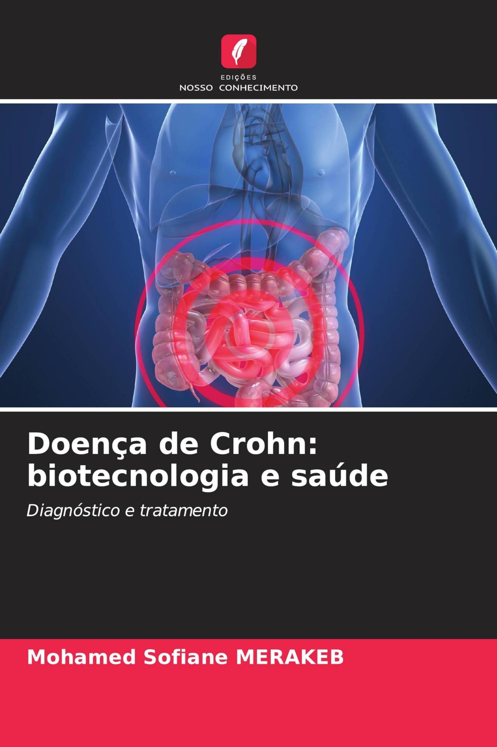 Doença de Crohn: biotecnologia e saúde
