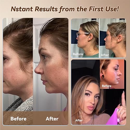 Miniatura 3 de JUSRON V-Line - Máscara de barbilla con correa facial, correa de barbilla de silicona suave en forma de V, ejercitador de mandíbula de 23 a 27