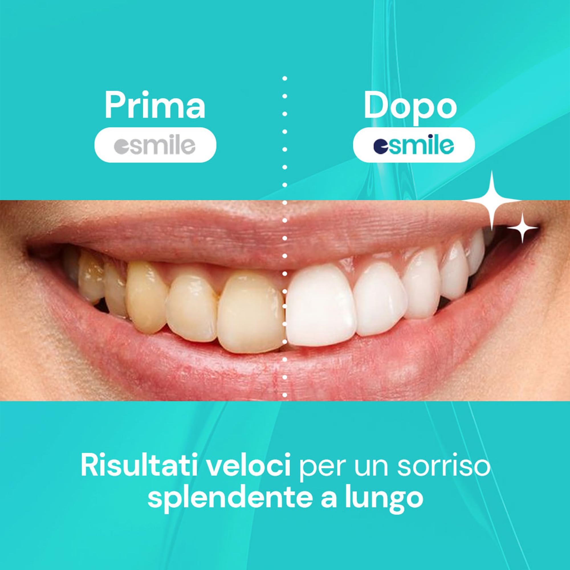 ESMILE: Kit lampada led + Strisce sbiancanti + Carbone