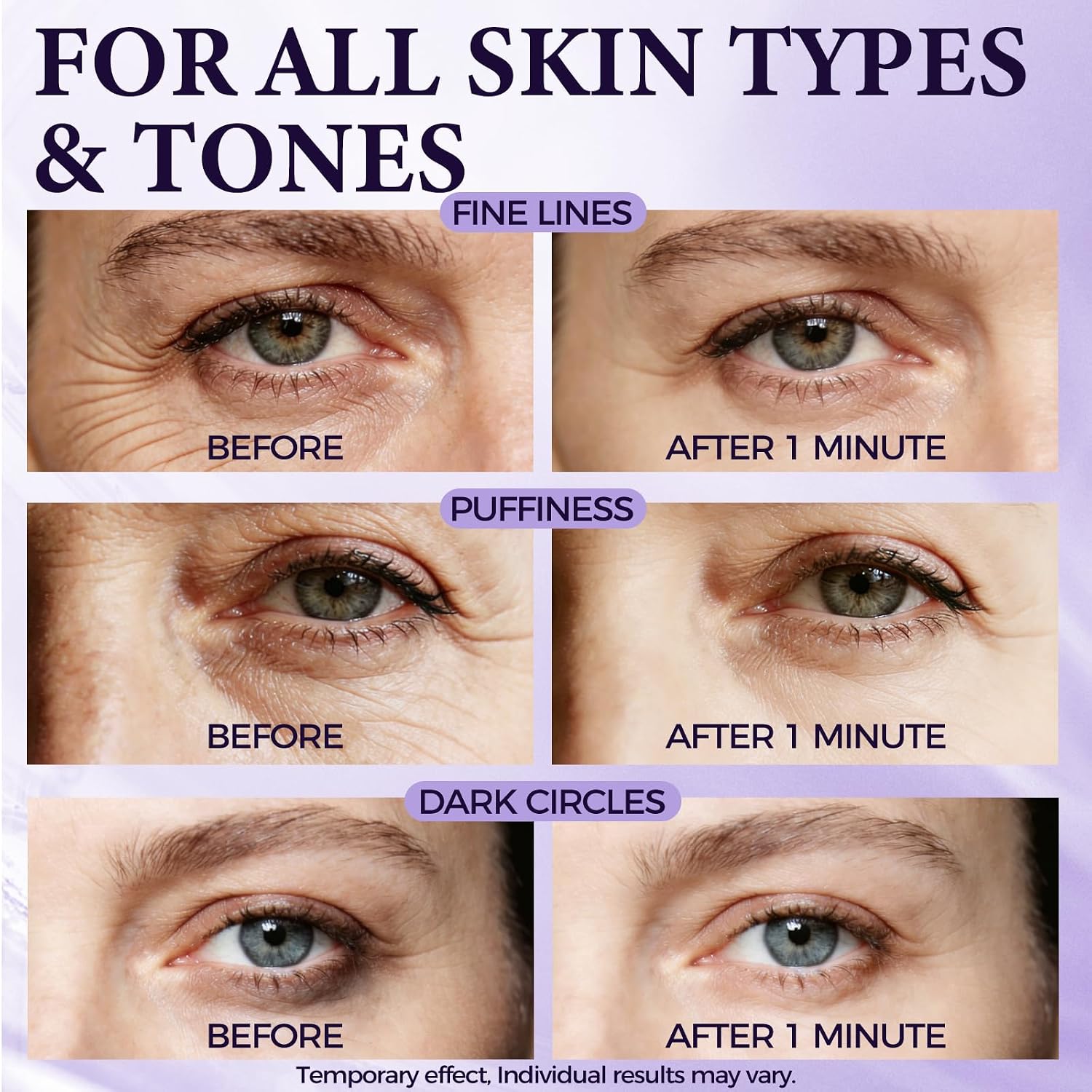 Tuggle Instant Eye & Face Tightening Serum, Instant Face Lift Cream Rapid Improve Under Eye Bags and Puffiness, Tightener Wrinkles & Fine Lines Fast, for Women & Men in 60 seconds, 0.70 oz thumbnail