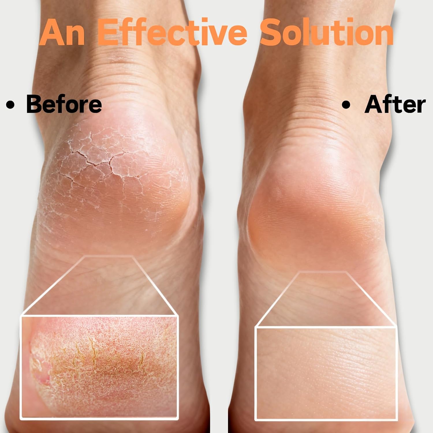 Glass Foot Files for Feet Tool, Heavy Duty Callus Remover for Cracked Heels, Foot Pumice Stone for Wet or Dry Use, 2 PCS