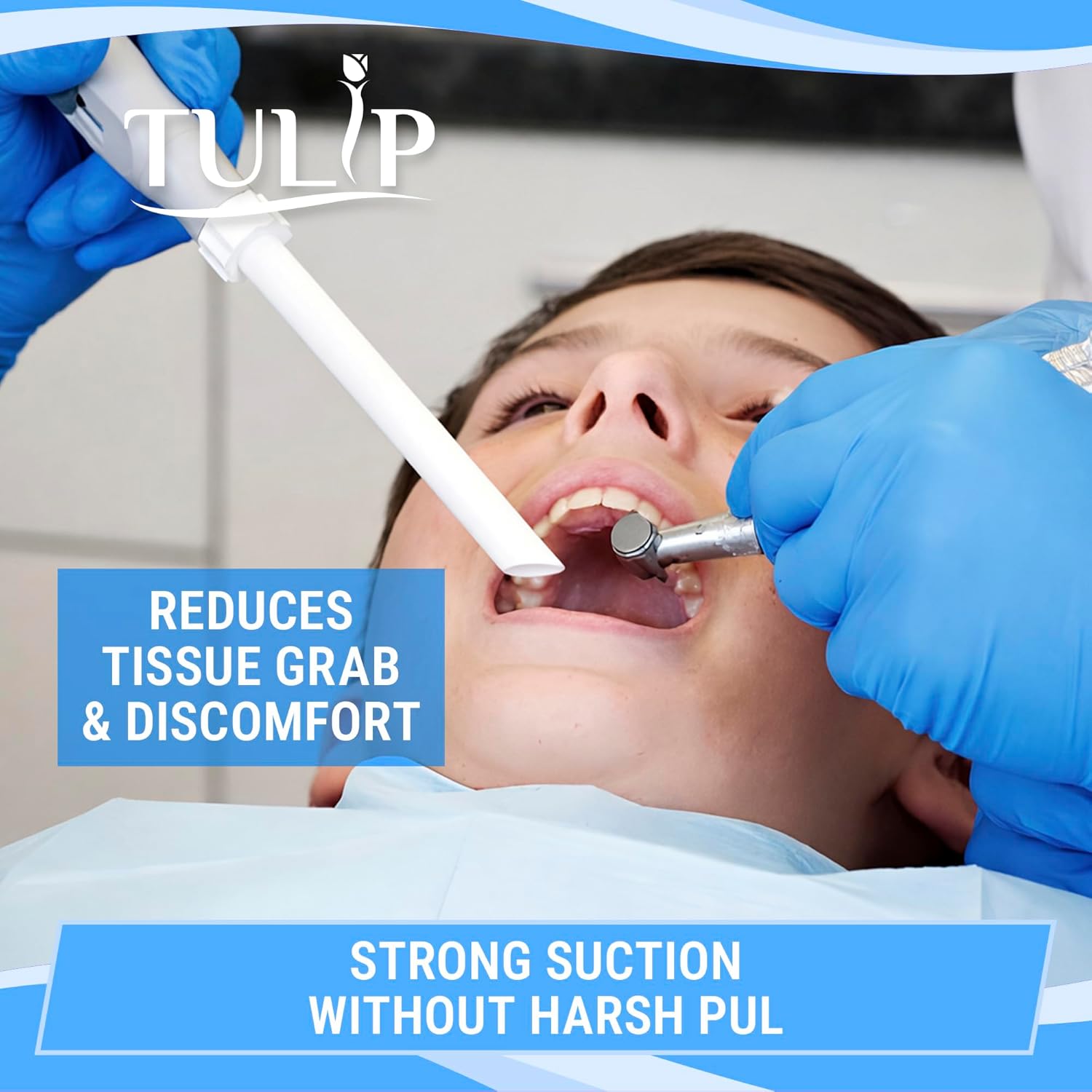 Tulip High Volume Evacuator HVE Tips - 1000 HVE Suction Tips Dental Disposable - Vented Evacuation Aspirator Tips with Smooth Edges (White - 10 Bags of 100)