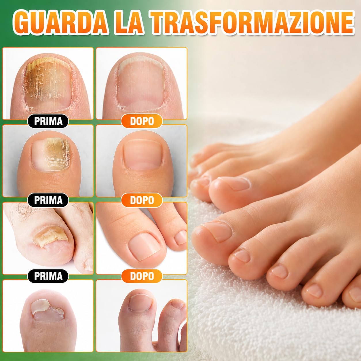 Micosi Unghie Piede Trattamento, Trattamento Funghi Unghie Piedi, Antimicotico Unghie Piedi Liquido, Migliora Unghie Spesse, Fragili, Rotte e Scolorite, Trattamento Rigenerante per Crescita Unghie