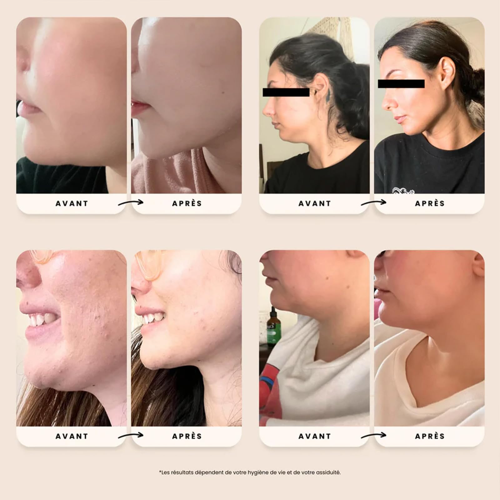 Sweetlifty Visage, Bande Raffermissante Pour Le Visage, Améliore Le Contour Du Bas Du Visage, Tissu Élastique Et Respirant, Convient À Tous (S)